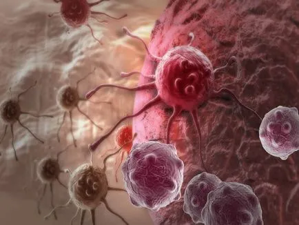 Учените са се научили как да се хранят раковите клетки