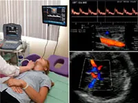 Doppler ultrahang hajók, a fej és a nyak, az agy, hogy mikor és mit kell csinálni