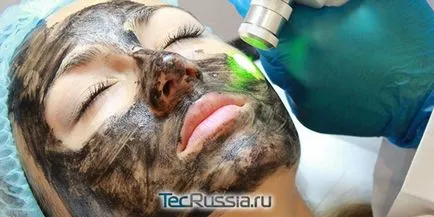 Skin Care után lézeres visszatérő vagy peeling - receptek gyors helyreállítás