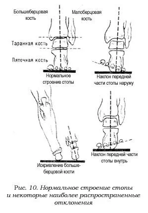 Конят има четири крака, а той се препъва