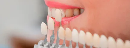 зъби подравняване без скоби за възрастни - най-ефективните методи за подравняване