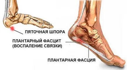 Спортна медицина лекар какво да правите, ако един млад играч болки в петата