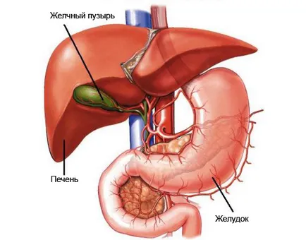 Cholesterosis diagnostic vezicii biliare, tratament