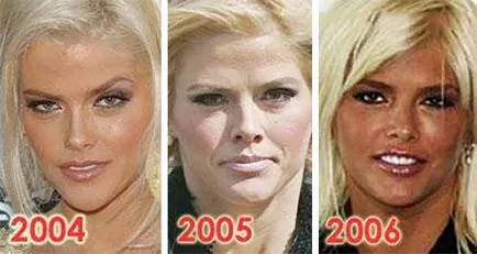 Anna Nicole Smith - biografia, viața personală, fotografii, filme și știri de ultimă oră