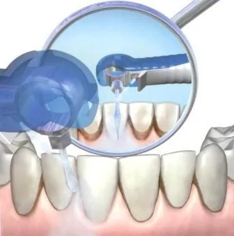 Векторът на единица в стоматологията прегледи на пациенти
