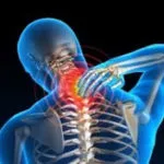 Bechterew-kór (spondylitis) kezelésére, a tünetek a férfiak, nők