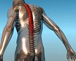 Bechterew-kór (spondylitis) kezelésére, a tünetek a férfiak, nők