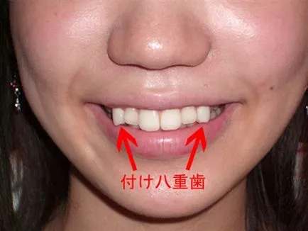 dintii stricati - și o nouă tendință fierbinte în Japonia