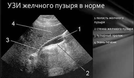 Aceasta arată o abdominale rezultate de decodare cu ultrasunete, rata de organe