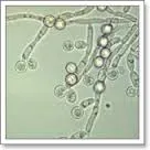 Diagnosticul candidozei (laborator, microbiologie), la femei și bărbați afte