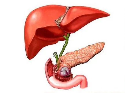 Duodeno gyomorrefluxot kezelésére népi orvosság - Egészségügyi információ