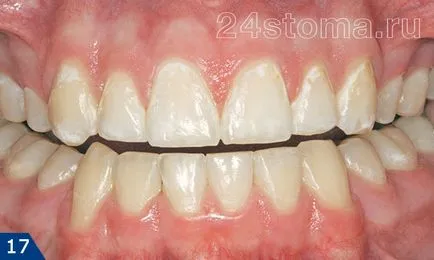Cele electrice periuță de dinți de comentarii stomatologi, modul de a alege, preț