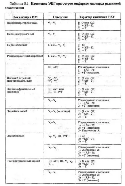 Electrocardiogram szívinfarktus tompa neki bal kamra