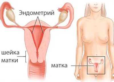 endometrium rák a nők, hogy a nőgyógyászati