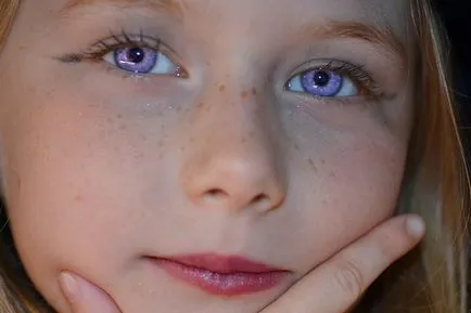 Violet szeme - mítosz vagy valóság?