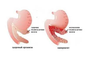 Пушенето и задстомашната жлеза