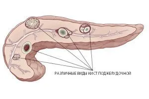 Fumatul și pancreasului