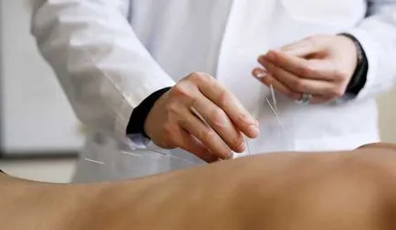 Acupunctura pentru astm (copii și adulți), acupunctura, puncte, comentarii