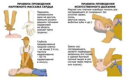 infarct cerebral ce este, simptomele și consecințele