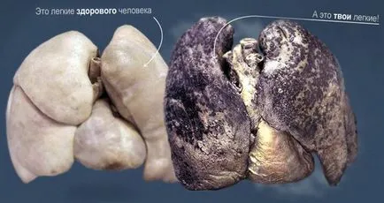 Как да се откажат от пушенето 1