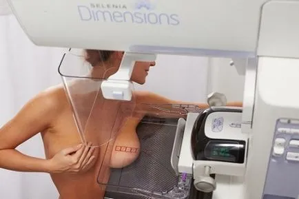 Hogyan készüljünk fel a mammográfia és hogyan végezzük