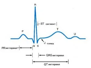 Hogyan megfejteni a szív EKG