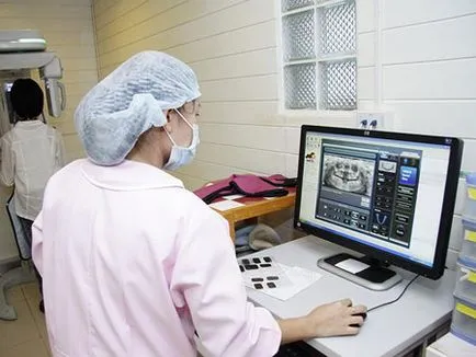 dinti tomografie computerizata 3D-shot pentru diagnostic