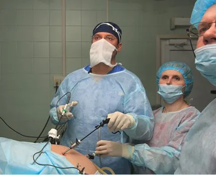 Tratamentul laparoscopic al herniei diafragmatice - tehnica de profesor la Puchkova