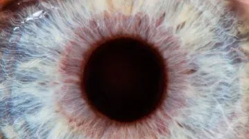 Макулна разкъсване на ретината и макулата симптоми дегенерация и лечение на влажна и възраст, етап,