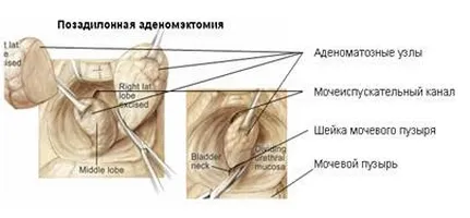 Методи за лечение на ВРН лук кожи, тествани няколко поколения