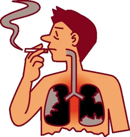Pot fuma în fața gastroscopie stomac și de ce nu se poate fuma în fața EGD