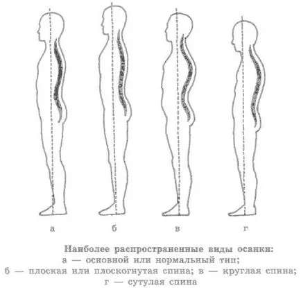 Ennek eredményeként a rossz testtartás, bekövetkezik, a következmények, a tünetek és típusai