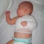 Ключицата фрактура при новородени причинява симптомите, лечението и последствия снимка