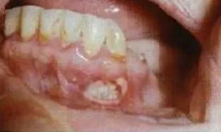 imagine cavității orale, bibliotecă dentară