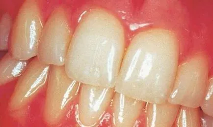 imagine cavității orale, bibliotecă dentară