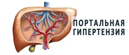 Портал за лечение на хипертония, симптоми, причини