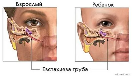 Причините за шума в главата ми