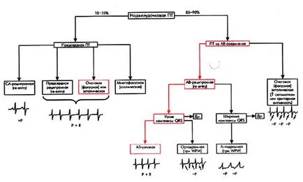 Предсърдното тахикардия пароксизмална Предсърдното пт