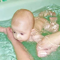 Пъпна херния в бебета симптоми, лечение на пъпна херния при деца