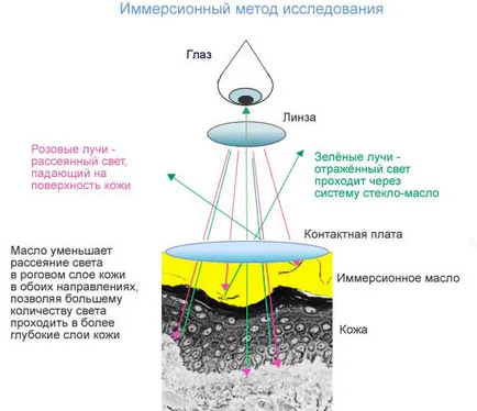 Pink зостер (Gibert) лечение при хора, причини и симптоми