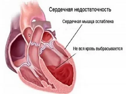 Cardiace cauze de formare edem, simptome, tratament