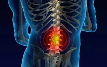 Spondylarthrosis coloanei vertebrale lombosacrala cauze, dezvoltare, diagnostic, tratament