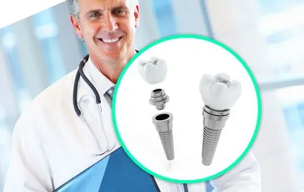 Az élettartam a fogászati ​​implantátumok, garancia beültetés