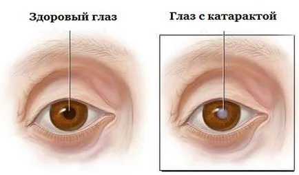 За обектив - микрохирургия на очите с