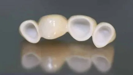 Foto punte dentară de 1, 2, 3, 4 dinți