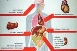 Алкохолът и съдове на мозъка въздействието на алкохола върху мозъка