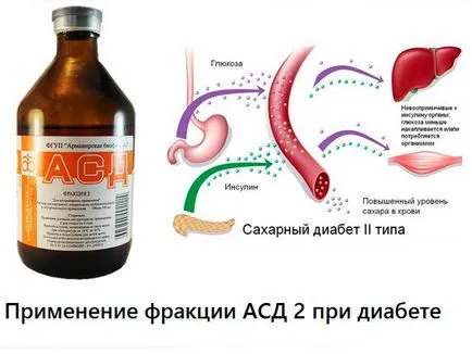 SDA 2 диабет тип 2 диабет ASD лечение фракция 2