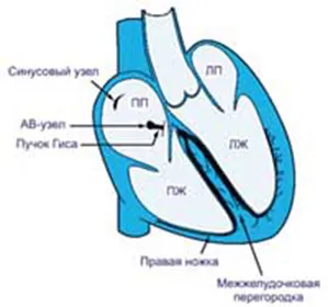 Blocada ramura anterioară tratamentului ramură stângă și simptome - Enciclopedia medical