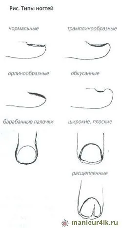 Капацитет на проблемни нокти