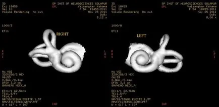 Mit jelent az MRI és CT kontrasztanyaggal vagy a belső fül